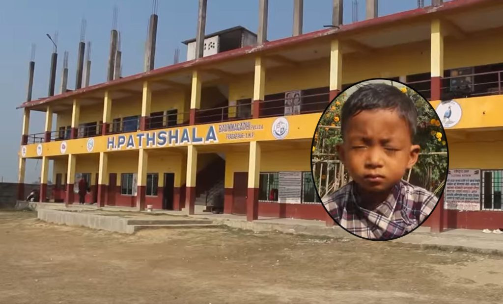 शिक्षिकाको कुटाइबाट यूकेजीमा पढ्ने विद्यार्थीको आँखा फुट्यो