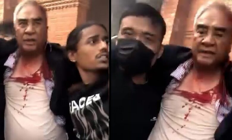 देउवाको टाउकोमा १२ टाँका, सैनिक अस्पतालमा भइरहेको छ उपचार