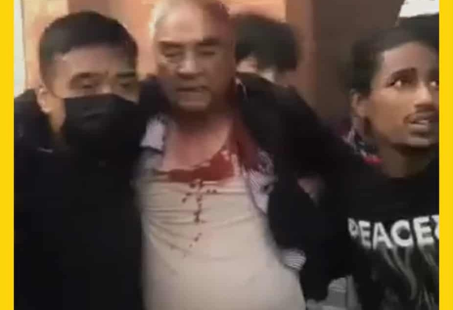 कांग्रेस सभापति देउवा र आरजु राणा घाइते